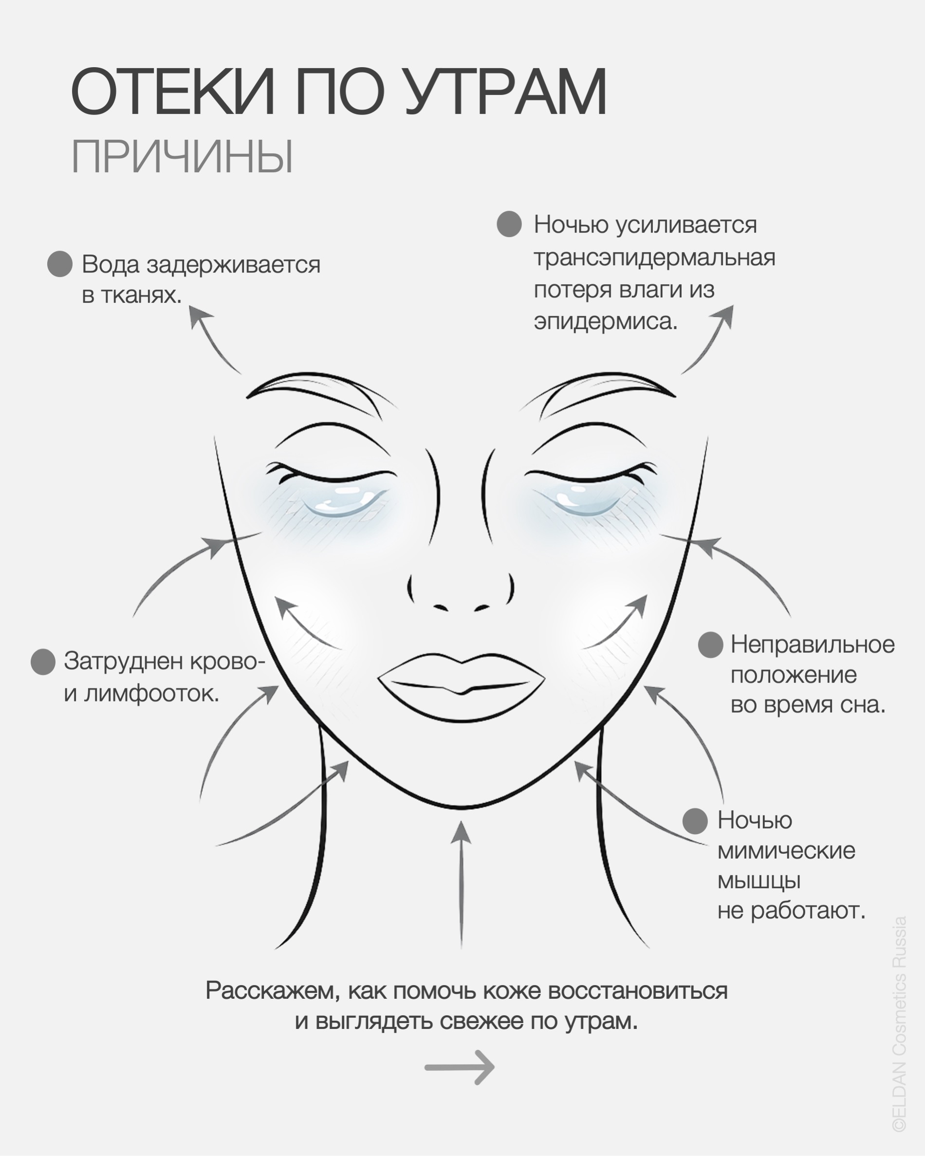 Пост утренние отеки гуаша 3.jpg
